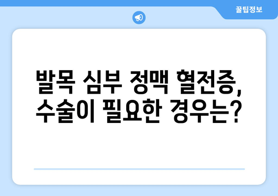 발목 심부 정맥 혈전증 수술| 필요한 경우와 선택 가능한 옵션 | 혈전증, 수술, 치료, 옵션, 선택