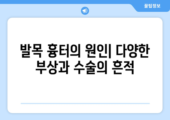 발목 흉터, 신체 건강에 미치는 영향| 원인, 증상, 치료 및 관리 | 흉터, 발목 부상, 건강 관리, 재활