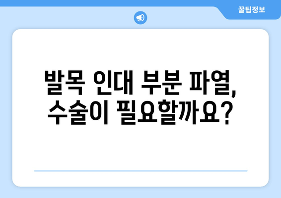 발목 인대 부분 파열 수술| 완벽 가이드 | 회복 과정, 재활, 주의 사항