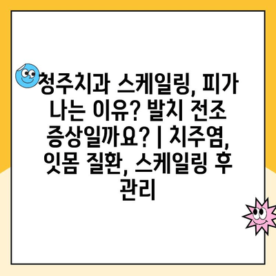 청주치과 스케일링, 피가 나는 이유? 발치 전조 증상일까요? | 치주염, 잇몸 질환, 스케일링 후 관리