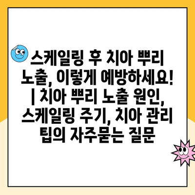 스케일링 후 치아 뿌리 노출, 이렇게 예방하세요! | 치아 뿌리 노출 원인, 스케일링 주기, 치아 관리 팁