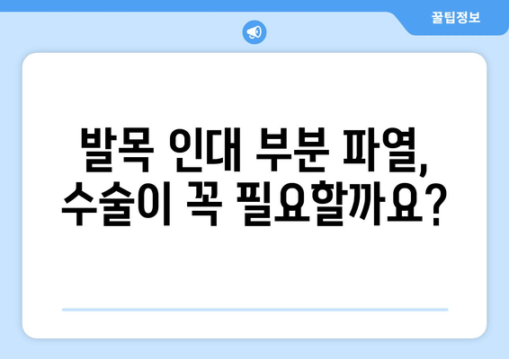 발목 인대 부분 파열, 수술 선택 가이드| 나에게 맞는 치료법 찾기 | 발목 인대 부분 파열, 수술, 비수술, 재활, 회복