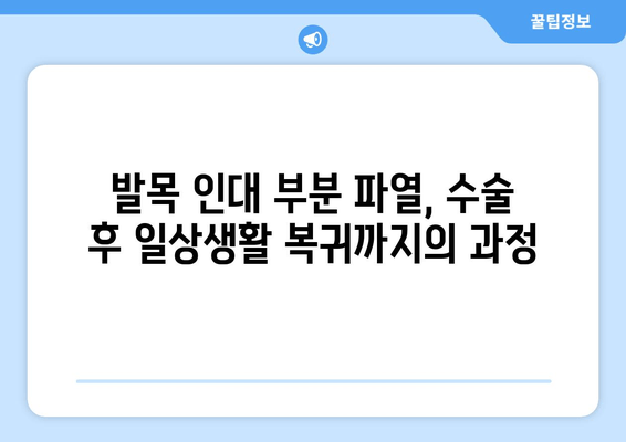 발목 인대 부분 파열, 수술 선택 가이드| 나에게 맞는 치료법 찾기 | 발목 인대 부분 파열, 수술, 비수술, 재활, 회복