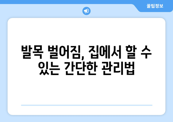 발목 벌어졌을 때? 붓기, 통증 완화하는 3가지 꿀팁 | 찜질, 파스, 치료법